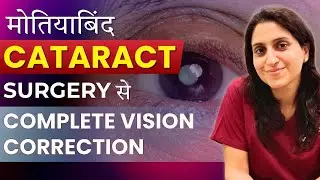 2026 Bladeless Robotic Cataract Surgery I Cataract Surgery That Removes Chashma
