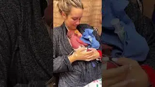 PREMATURO 30 SEMANAS ANTES E DEPOIS