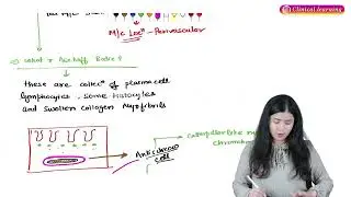 2. Rheumatic Heart Disease (Part-1) Pathology: Hindi