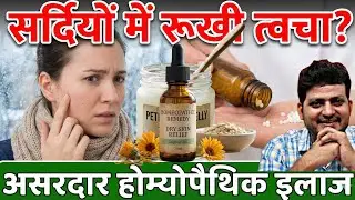 Dry Skin External Homeopathic Medicine Combination ? How to Use | 