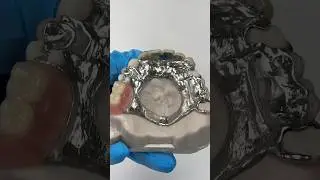 Amazing Chrome Cobalt Partial with Lingual Protection #lsk121shorts #dentist #teeth