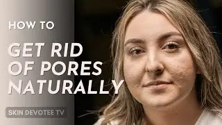 How to Shrink Pores Naturally 🌱