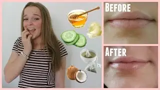 Простые способы вылечить потрескавшиеся губы за считанные минуты!