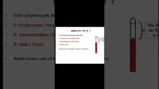 ESR Test 🧑&zwj;⚕️👩&zwj;⚕️.                          #laboratory #knowledge #exprience #viral #short