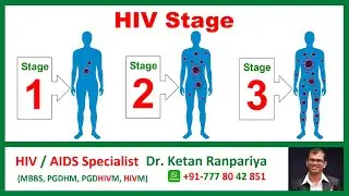 Stages of HIV | hiv stages and symptoms | hiv stage 1 early symptoms | Acute HIV Infection | AIDS