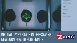 Newborn screenings vary by state testing or not testing for potentially life-threatening diseases