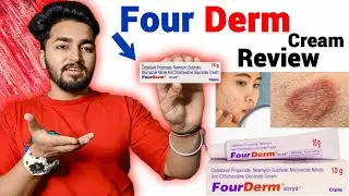 Fourderm Cream Review | Fourderm Cream Kis Kam Ati Hai