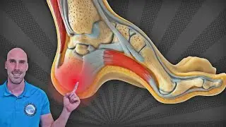 Heel Pain Relief: 3 Exercises for Plantar Fasciitis