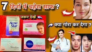 Best Soap for face whitening | गोरा करने वाला साबुन? | Acne Pimples Dark Spots