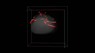 3D images of benign and malignant breast tissue masses