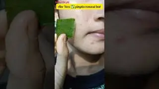 😱 ALOE VERA PIMPLES REMOVAL FACE PACK AT HOME 🏡#pimple #aloevera #shorts #skincare #facepacke