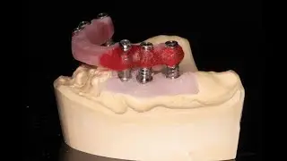 Verification jig in Dentistry | CAD CAM Dental Lab