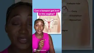 Тампон потерялся во влагалище?