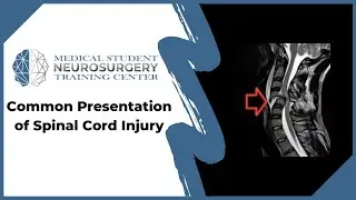 Common Presentation of Spinal Cord Injury