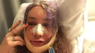 20180908 0804 - Claire's FFS - day 5  - 96 hour update