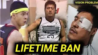 Sinapak ni Arwind Santos, maaaring mabulag! Bakit ginawa ng PBA LEGEND! Possible Lifetime Ban