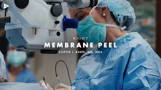 Right Membrane Peel by Sophie J. Bakri, MD, MBA | Preview