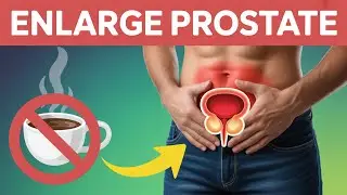 Stop Using! 10 Drinks Harming Your Enlarged Prostate | Life After 60