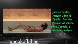 #bookofkilian presents the passion of jeshua ben joseph, a medical analysis