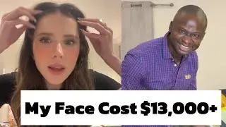 My Face Cost $13,000+