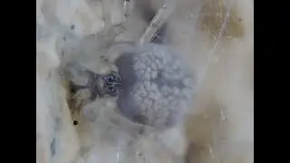 Striped Lynx Spider(Oxyopes Salticus) and Wall Spider(Oecobius Navus)