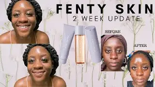 FENTY SKIN Review- With Before & After Pics!