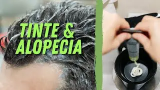 ¿USAR TINTE EN EL CABELLO PUEDE PROVOCAR CAÍDA DE PELO? SE PUEDE USAR TINTE SI SI SUFRES AGA?