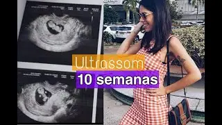 ULTRASSOM 10 SEMANAS! Emoção ao ver o bebê mexendo!