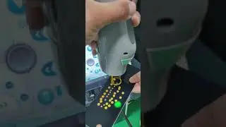 Alexandrite Laser Vascular Removal with Gas Cooling System