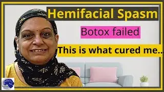 Hemifacial spasm. Cheek Vibration. Eye Flickering. Hemifacial spasm cure.