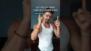 How to Get Rid of Dark Circles Under Eyes in 5 min