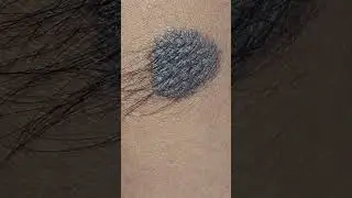 Spot Diagnosis #imwell #wellnessforlife #bangalore #drshashikant #clinic #Bangaloreclinic #doctor 🩺🌟