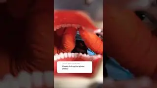 Teeth Clicking #asmr Just for Angelina - Doctor Hard&rsquo;s Personal Mouth Sounds Session 🦷 #dentistasmr