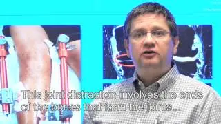 Prof.dr. Floris Lafeber, hoogleraar Experimentele reumatologie