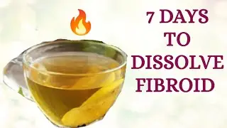 DETOX To Remove Cysts & Fibroids Before 7 Days - World Like Magic