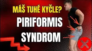 Piriformis syndrom , jak ře&scaron;it ? 