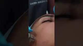 Diamond Glow Facial