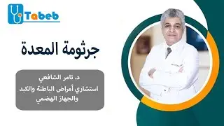 تحاليل وفحوصات ضرورية لجرثومة المعدة