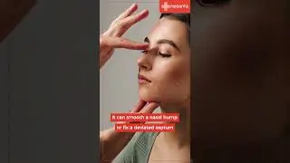 It&rsquo;s More Than Just a Nose Job