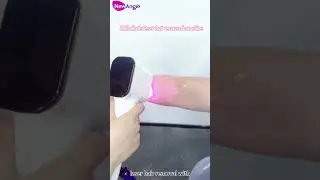 Newangie 808 diode laser hair removal machine