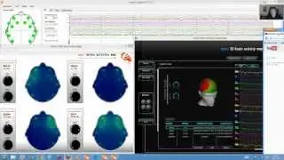 Music therapy EEG