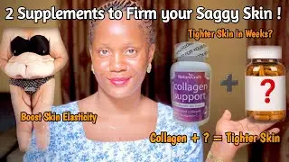 The Real Skin Firming Supplements You&rsquo;re Missing! || Saggy Skin, Loose Skin & Cellulite