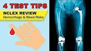 Hemorrhage Bleeding Risk   Preoperative Patient Education for NCLEX review