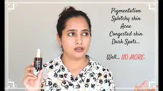 SESDERMA AZELAC RU Liposomal Serum TRX Review | Hindi