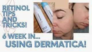 DERMATICA: 6 weeks in! Peeling? Routine? How's it going? | Altogetheralanna