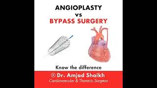 Angioplasty vs Bypass Surgery. Know the difference - Dr. Amjad Shaikh