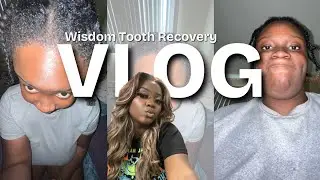 THEY TOOK MY TOOTH 😱🦷 + Recovery Vlog