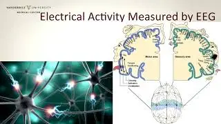 Brain Electrical Activity