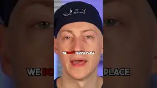 Watch This Before Getting a Hair Transplant!