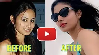 Plastic Surgery Photos Of Popular TV Actresses BEFORE & AFTER | TV Prime Time